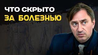 Как мысли превращают энергию в болезнь? Сергей Серебряков