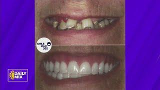 Smile Max 365 can restore your smile and give you confidence