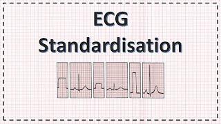 ECG Paper and Standardisation | ECG Interpretation Basics | Simplified Explanation