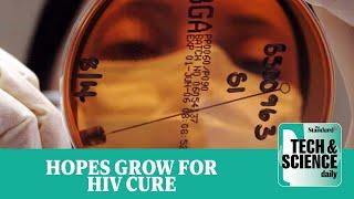 HIV cure breakthrough as virus eliminated from cells ...Tech & Science Daily podcast