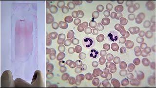 Blood Smear Preparation and Staining Practical Lab