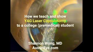 How we teach college students about YAG capsulotomy.