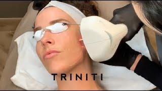 The Triniti Laser Series at It's A Secret Med Spa