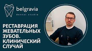  Реставрация жевательных зубов. Клинический случай