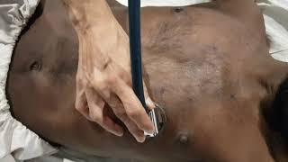 CVS Examination (Auscultation), Dept. of Medicine, JNMC.