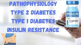 Insulin resistant cells. Pathophysiology of Type 2 and Type 1 diabetes