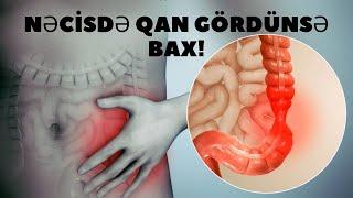 BAĞIRSAQDAN GƏLƏN QAN NƏDƏN XƏBƏR VERİR? - Mütləq Dəqiqləşdirmək Lazımdır