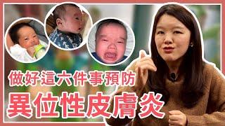 寶寶異位性皮膚炎！該如何才能預防惡化？6種方式護理嬰兒肌膚，日常必備用品須知！