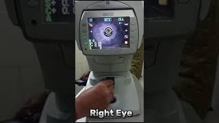 Computerized Machine (AR) se Eye Testing And Keratometry (k1&k2) measure krna