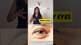 Check comments for eye cream recommendations. love,Dr Vanita Rattan #eyecream