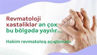 Revmatoloji xəstəlik ən çox bu bölgədə yayılır...Həkim #revmatoloq açıqlaması