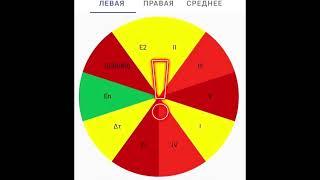 Боль из-за спазма сосудов