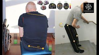 Post-Stroke Postural Instability: suboptimal truncal control and fear of falling