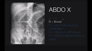 Abdominal x-rays