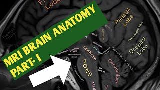 MRI BRAIN ANATOMY PART -I            AND PATHOLOGY WITH DEEP KNOWLEDGE FOR BEGINNER'S 