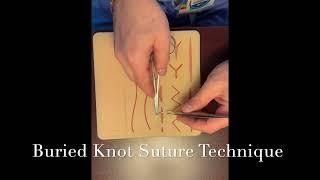 Buried Knot Technique Demo