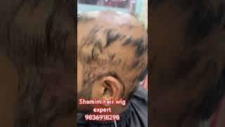 Hair wig for men’s.hair patch for men’s.hair patch centre in Kolkata.non surgical hair patch.haircut
