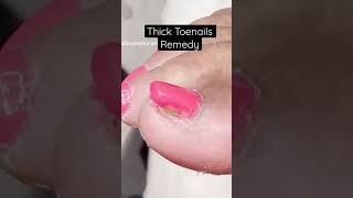 Thick toenails remedy. Let me show you how to restore your nails :) #dremel #electricfile #toenails