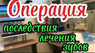 Операция! Последствия лечения зубов!