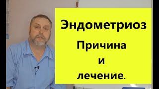 Борьба с эндометриозом: от причин до лечения.