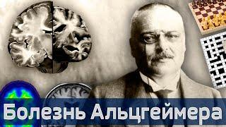 Болезнь Альцгеймера: счастье от ума! | iНЕВРОЛОГ