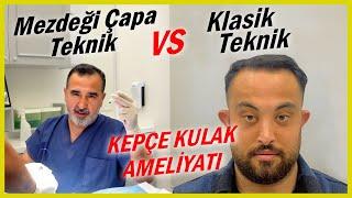 Klasik Kepçe Kulak Tekiniği Vs Çapa Tekniği #kepçekulakestetiği