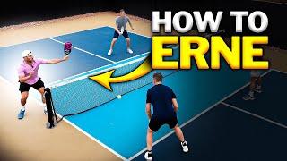 Master the Erne: A MUST HAVE WEAPON in Your Pickleball Game