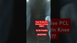 How To See PCL Avulsion In Knee MRI ?? Dr Sai Chandra..9573517107