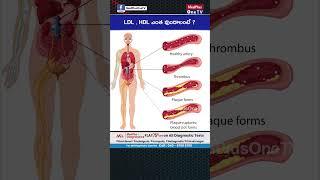 HDL Vs LDL Cholesterol : LDL,HDL ఎంత ఉండాలంటే ? @MedPlusONETV