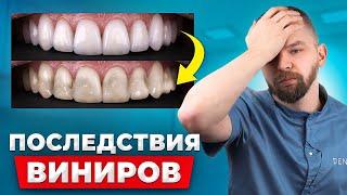 Вот что будет с вашими винирами! Последствия о которых не говорят