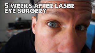 PRK vs Lasik Eye Surgery? I went with PRK