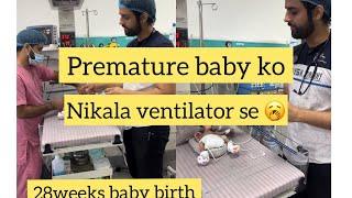 Premature baby  ventilator off # mini vlogs # share #like # subscribe #comments ️️