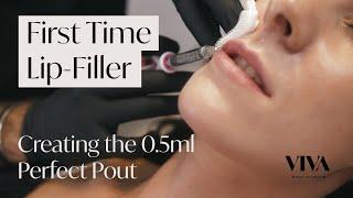 Getting Lip Fillers for the First Time   Everything You Need to Know about Lip Fillers