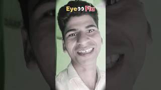 Eye  Flu |आई फ्लू #funny #shortsviral #comedy #shortvideo #injoy #trending