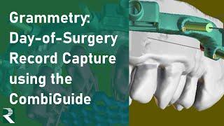 Grammetry: Day-of-Surgery Record Capture using the CombiGuide