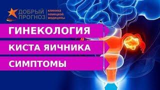 Что такое КИСТА ЯИЧНИКА и по каким симптомам можно её определить?