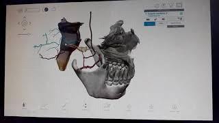 Visible Body 2018 - Human Anatomy Atlas資料庫