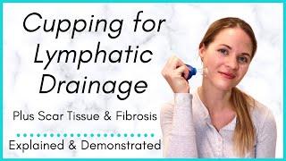 Cupping for Lymphatic Drainage, Tightness, and Fibrosis/Scars - Negative Pressure Therapy Explained