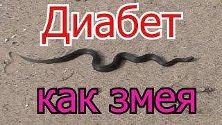 диабет, ответы на вопросы