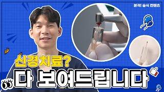 신경치료? 다 보여드립니다! ㅣ 신경치료 과정이 궁금하시다면 지금 바로 클릭하세요!