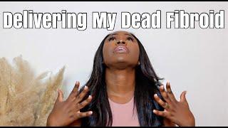 My Fibroid Died Inside of Me | Story Time | Fibroid Awareness