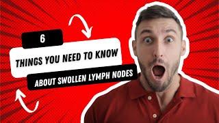 6 things you need to know about swollen lymph nodes (or swollen glands) #SpotLeukaemia