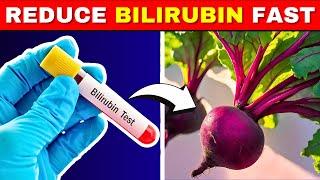 Reduce Bilirubin Levels Quickly with These 5 Superfoods