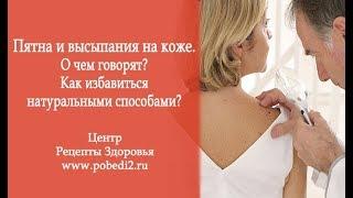  Почему у меня появляются пятна и высыпания на коже? 2 самые частые причины!