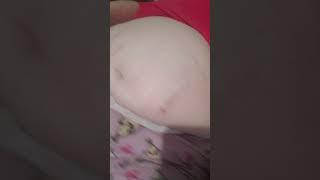 Can u see the red mark on FATTER belly