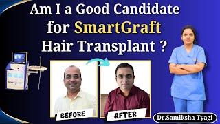 Am I a Good Candidate  for SmartGraft Hair Transplant ? | The Future of Advanced Hair Restoration