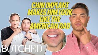 Will's SECRET Chin Implant Makes His Face Asymmetrical (BEFORE & AFTER) | Botched | E!