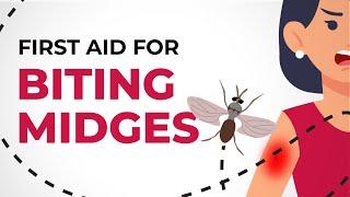 First Aid for Biting Midges