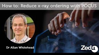 How to: Reduce x-ray ordering with ultrasound - Zedu POCUS Coaching Corner - 4 November 2021