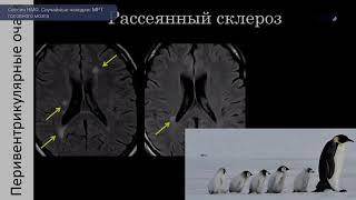 Сессия  «Случайные находки: МРТ головного мозга»